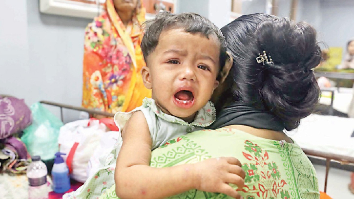হাম ও হামের উপসর্গে আরও ৮ শিশুর মৃত্যু