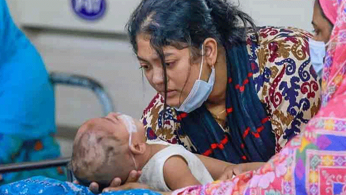 হাম উপসর্গে আরও ৮ শিশুর মৃত্যু